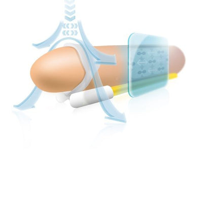 Extensor peniano ANDROPENIS Mini para aumento e correção do pénis.